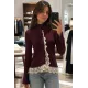 Kadın Etek Ucu Ve Ön Kısmı Dantelli Ceket
